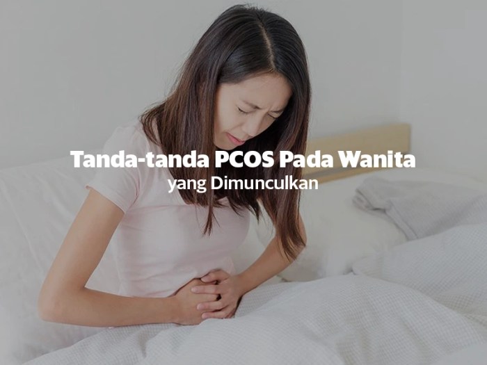 Ciri-Ciri PCOS pada Wanita