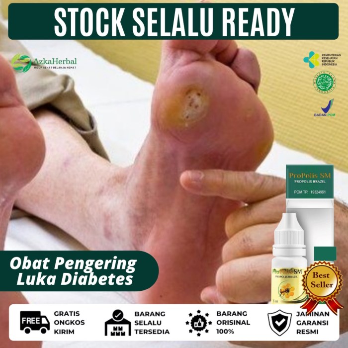 Obat Pengering Luka