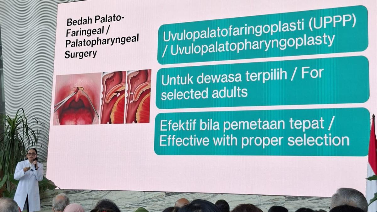 Mendengkur Tidak Menandakan Tidur yang Nyenyak menurut Dokter