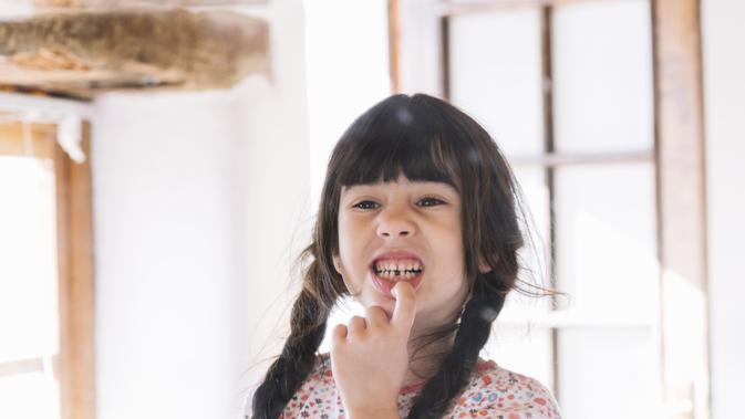 Masalah Gigi Anak Sering Diabaikan, Dokter Hanya Dihubungi Saat Sudah Parah